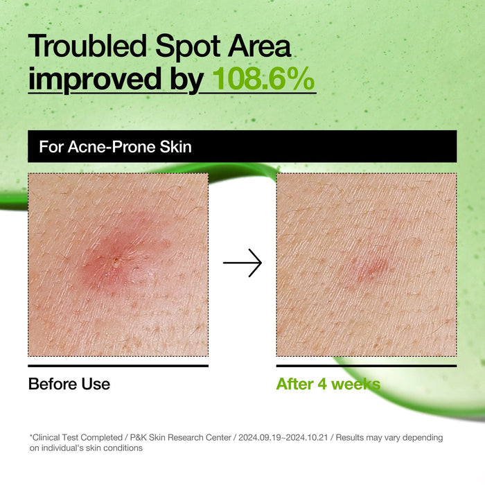 ClearTone Serum