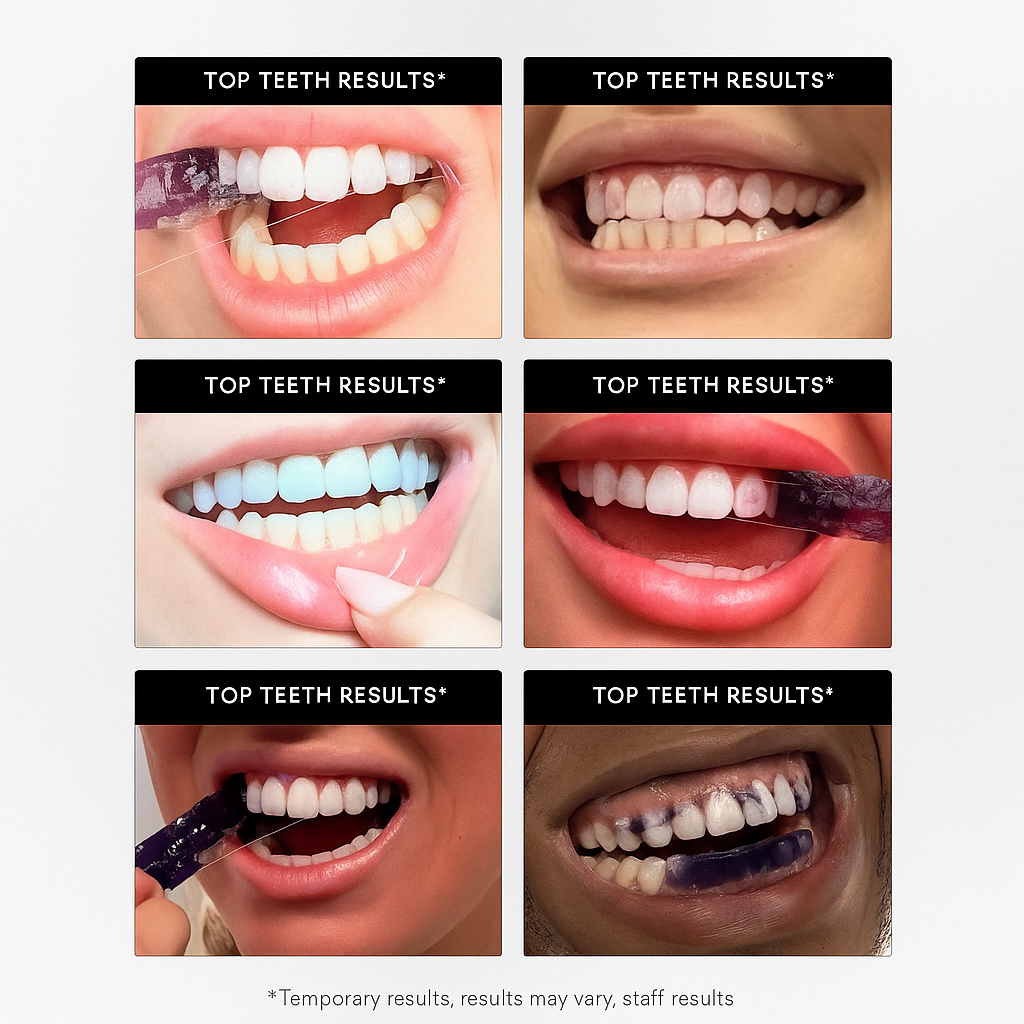 GlowV34™ Whitening Strips