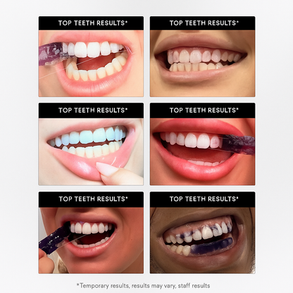 GlowV34™ Whitening Strips