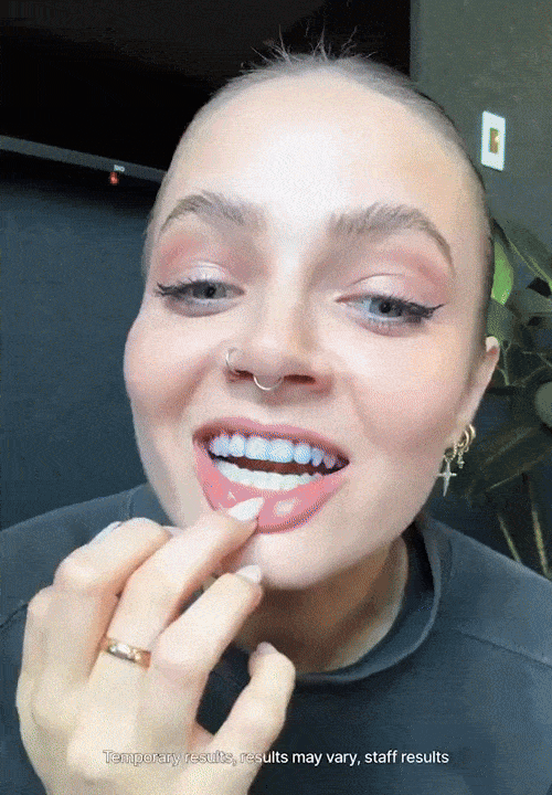GlowV34™ Whitening Strips