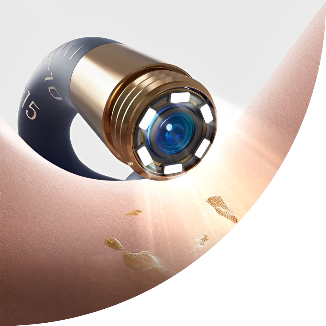 Original Bebird EarSight