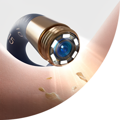 Original Bebird EarSight