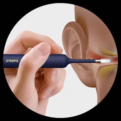 Original Bebird EarSight