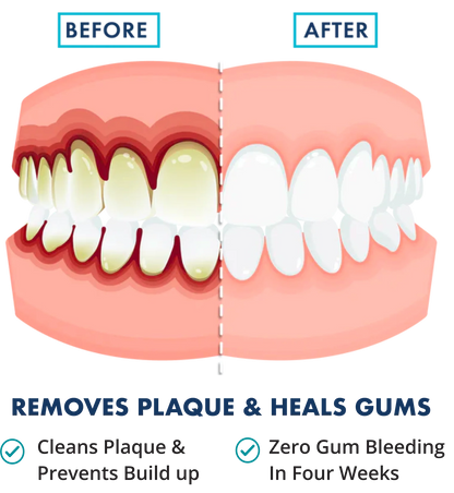 Revolutionary Gel Toothpaste – Breakthrough Oral Care Formula