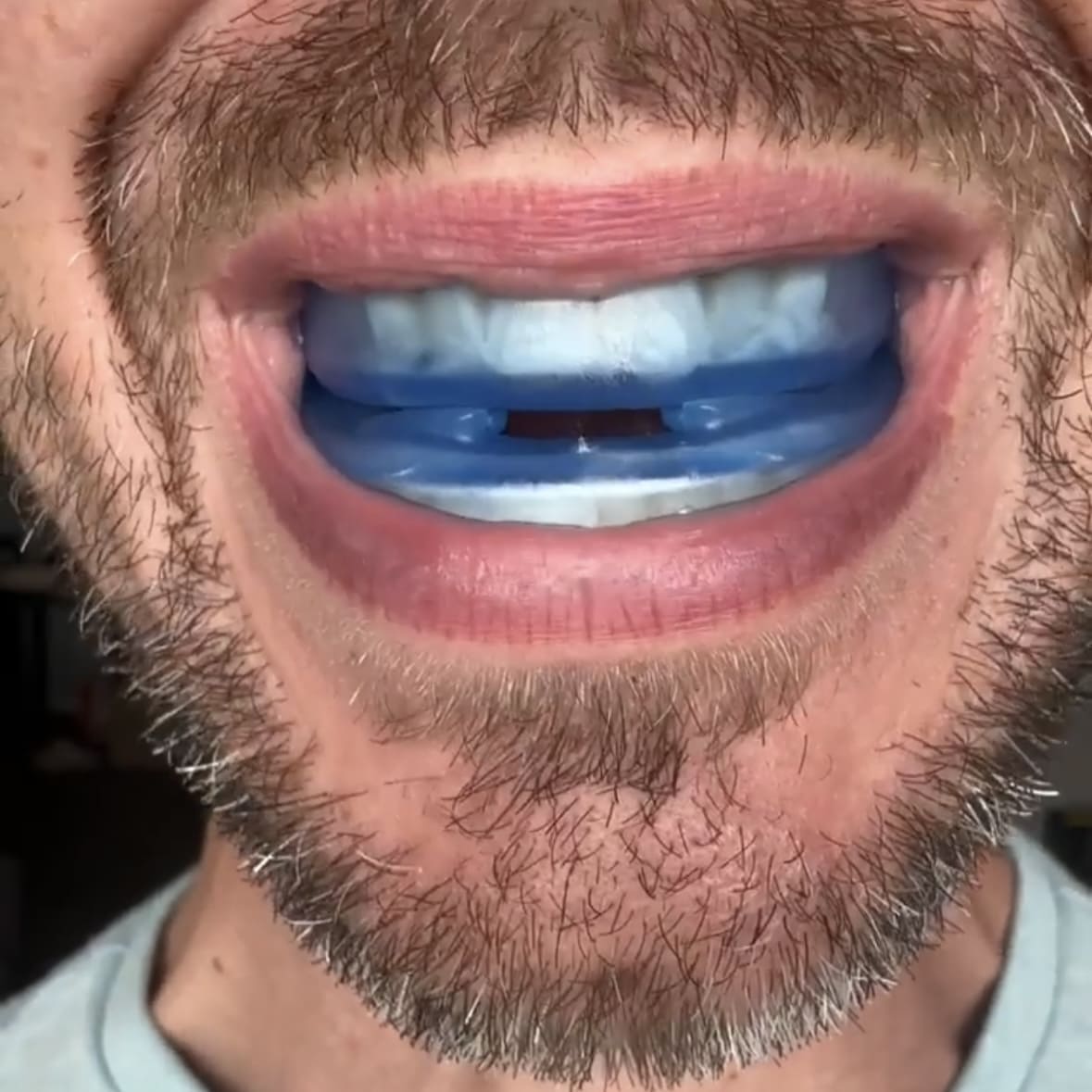 Honex Mouthpiece