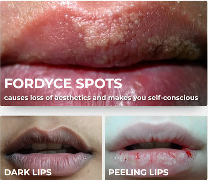Dark lips Cream