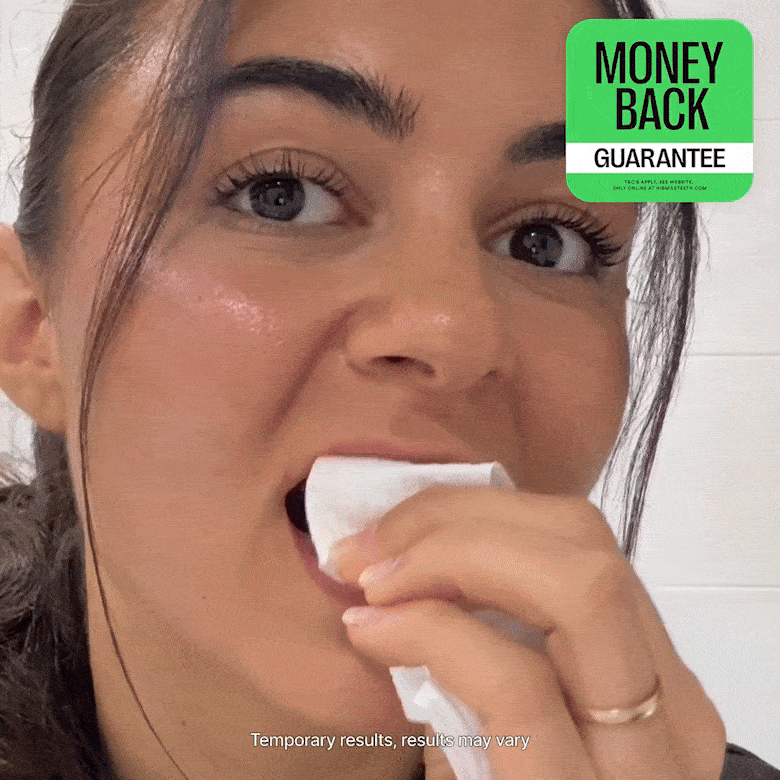 GlowV34™ Whitening Strips